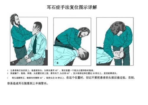 耳石症如何自我复位？