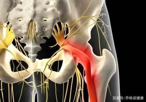 坐骨神经损伤多久可以好呢？