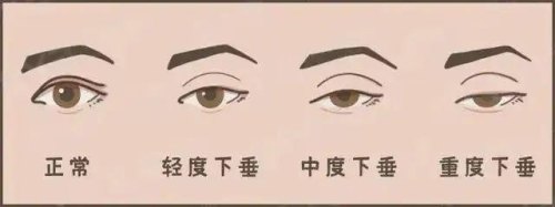 头沉眼皮重老想睡觉是什么原因？